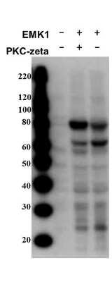 Western Blot: MARK2 [p Thr595] Antibody [NBP1-78028]